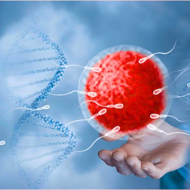 IUI –Intrauterine Insemination or Artificial Insemination (AI)